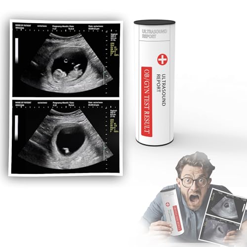 Custom Fake Ultrasound Prank Photo Personalized Pregnancy Sonogram with Your Custom Info Funny Gag Gift for Pranks and Parties 12 Weeks