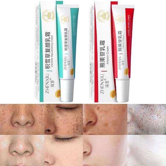 1 Set (2pcs) Dark Spot Correcting Glow Serum,Skin Repairing Serum Brightening Fade Sun Spots Pimple Marks Facial Serum,Skin Brightening Serum Collagen Boosting Serum Nicotinamide Skincare Serum