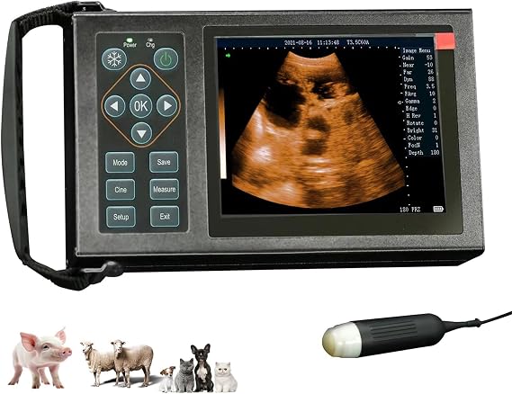 Ultrasound Machine M10 with 3.5 MHz Ultrasound Probe