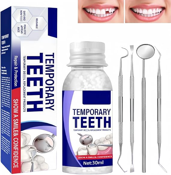 Tooth Filling Repair Kit, Temporary Tooth Repair, Temporary Tooth Filling Repair Kit, Filling Repair Beads for Fixing Missing Teeth, Reusable Fake Teeth Repair Beads for Broken or Missing Teeth