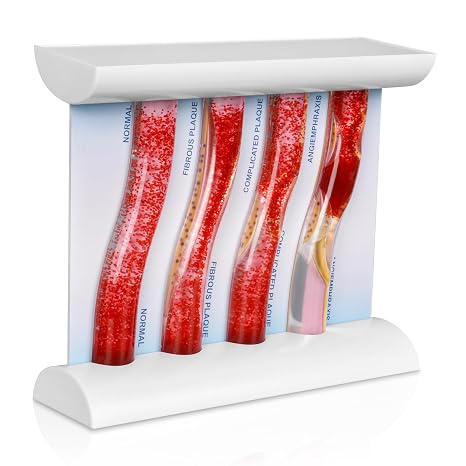 SimCoach Low-Density Lipoprotein LDL Blood Vessel Model for Medical Patient Doctor Teaching, Vascular Demonstration Training Tool, Large Size